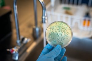 בדיקת חיידקים במים
